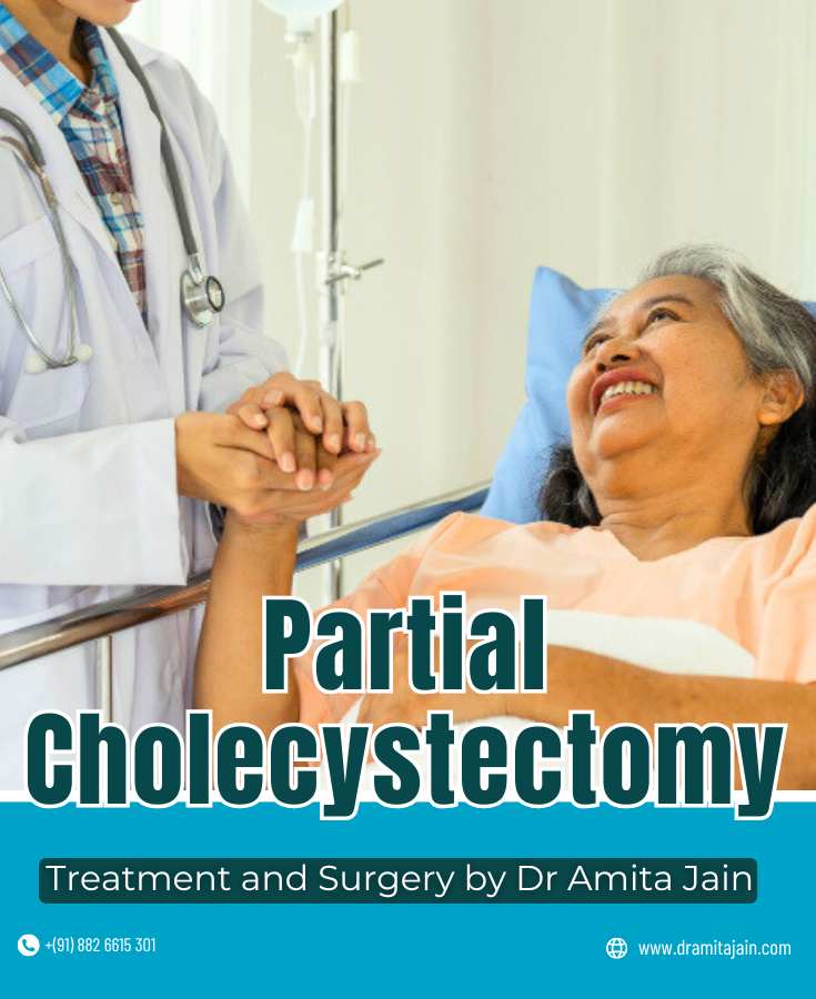 Partial Cholecystectomy Dr Amita Jain